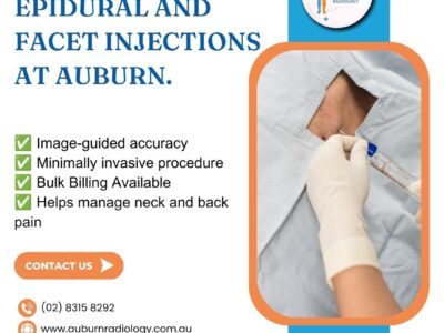 Find Relief with Epidural and Facet Injections at Auburn Radiology. (02) 8315 8292 2 Find Relief with Epidural and Facet Injections at Auburn Radiology. 02 8315 8292