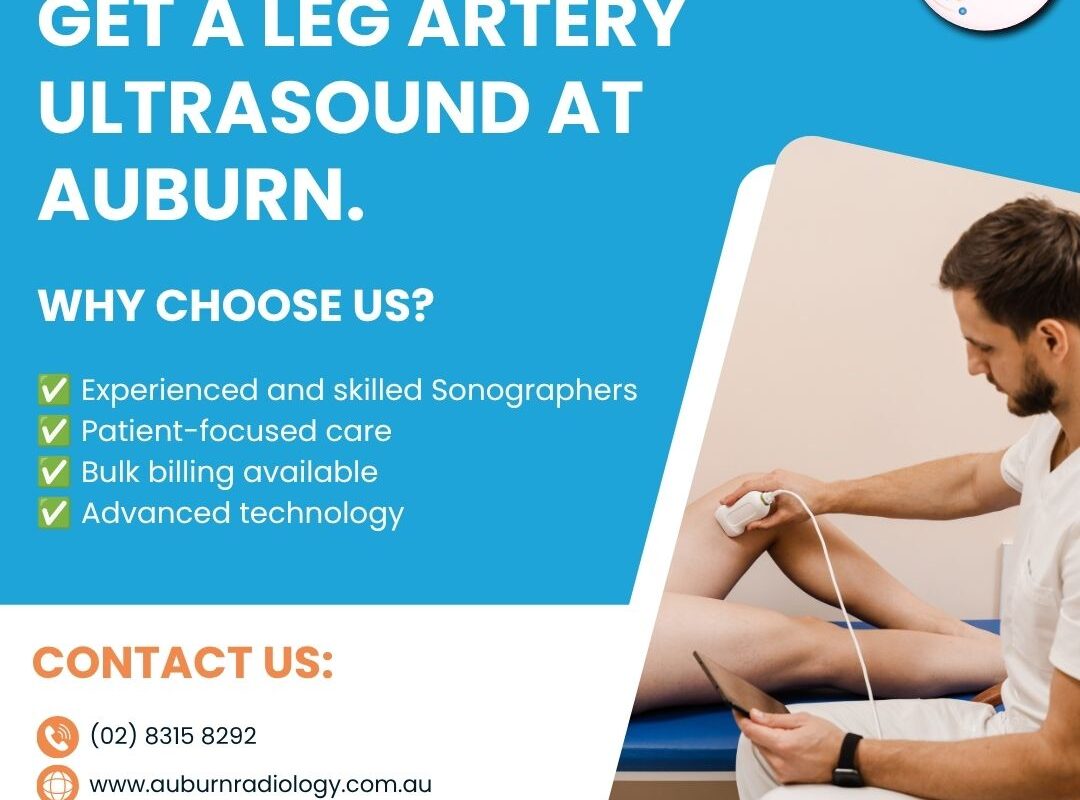 Get a Leg Artery Ultrasound at Auburn Radiology! (02) 8315 8292 1 Get a Leg Artery Ultrasound at Auburn Radiology 02 8315 8292