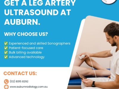 Get a Leg Artery Ultrasound at Auburn Radiology 02 8315 8292