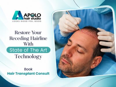 Hair patch in sector 45 noida