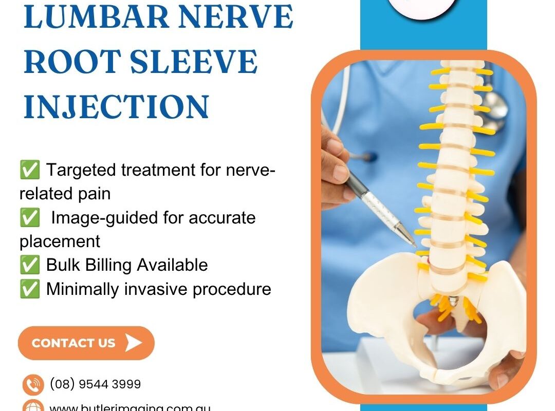 Lumbar Nerve Root Sleeve Injection at Butler Medical Imaging. (08) 9544 3999 1 Lumbar Nerve Root Sleeve Injection at Butler Medical Imaging. 08 9544 3999