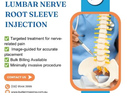 Lumbar Nerve Root Sleeve Injection at Butler Medical Imaging. 08 9544 3999