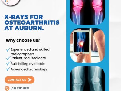 X rays for Osteoarthritis at Auburn Radiology. 02 8315 8292
