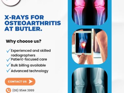X-rays for Osteoarthritis at Butler Medical Imaging. (08) 9544 3999 7 X rays for Osteoarthritis at Butler Medical Imaging. 08 9544 3999